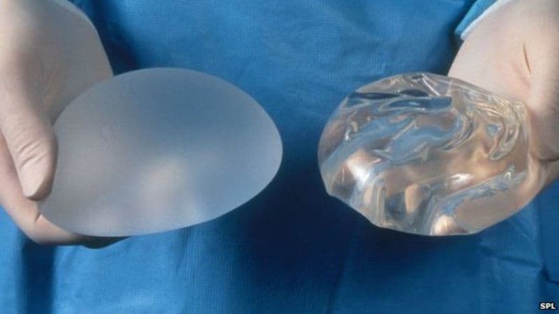 Implantátum